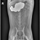 Illustration for article titled 5 X-Rays That Reveal The Craziest Things Pets Have Ever Swallowed